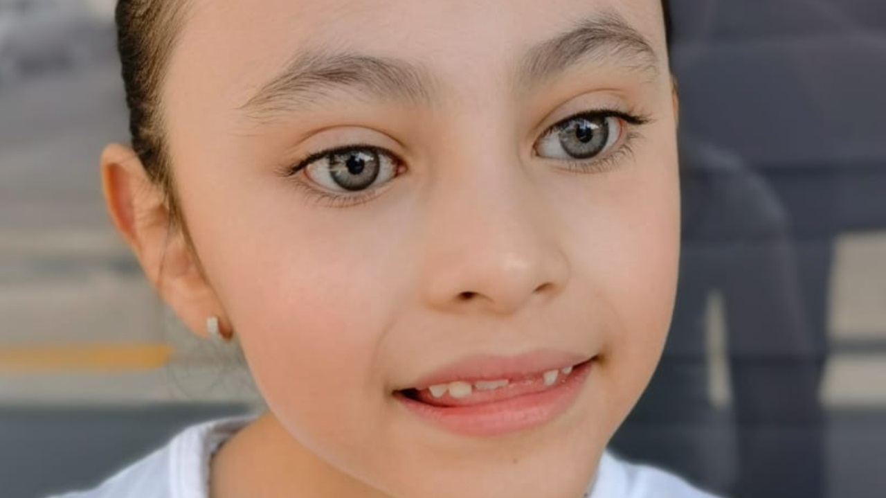 Prótesis ocular personalizada México - Resultado natural perfecto - Ocularista ASO