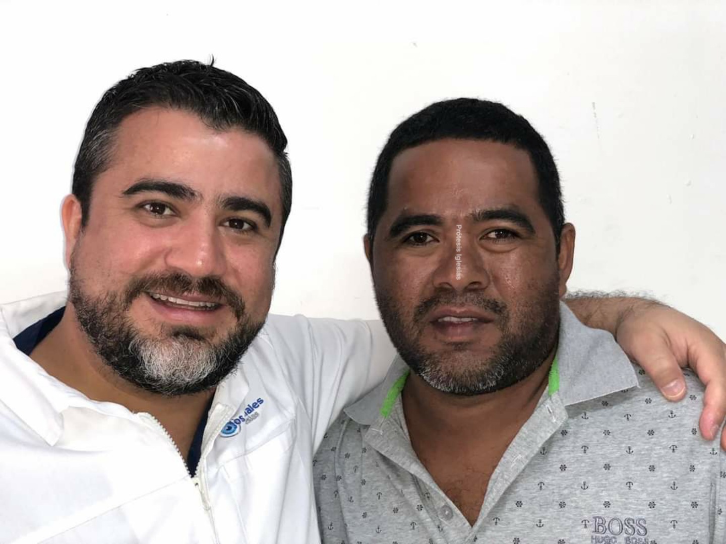 Concha esclerocorneal México - Ptisis bulbi tratamiento - Sin cirugía invasiva