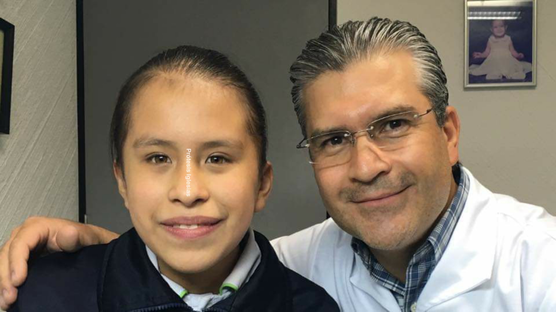 Ojo artificial Monterrey - Desprendimiento retina - Recuperación estética avanzada