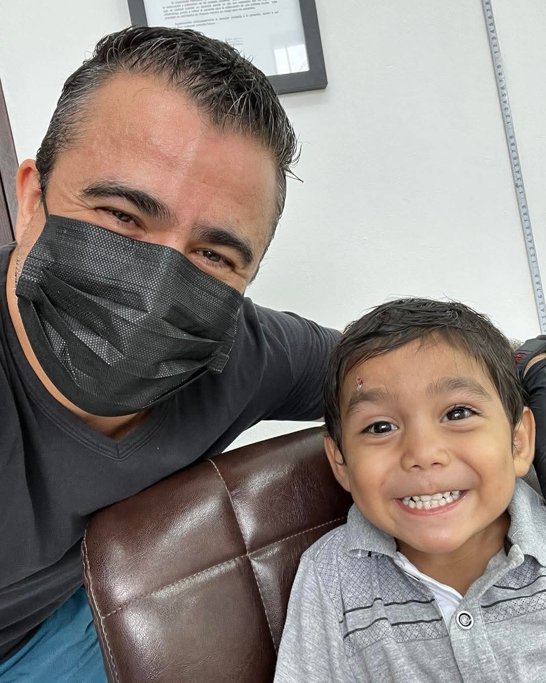 Concha esclerocorneal Nicaragua - Preservación ocular - Alternativa a enucleación